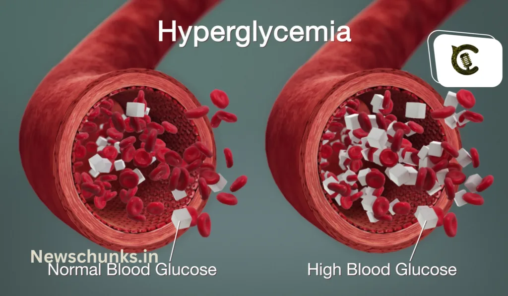 Kya Hai Hyperglycemia: क्या है हाइपरग्लेसेमिया, जानें डायबिटीज मरीजों के लिए कितना खतरनाक