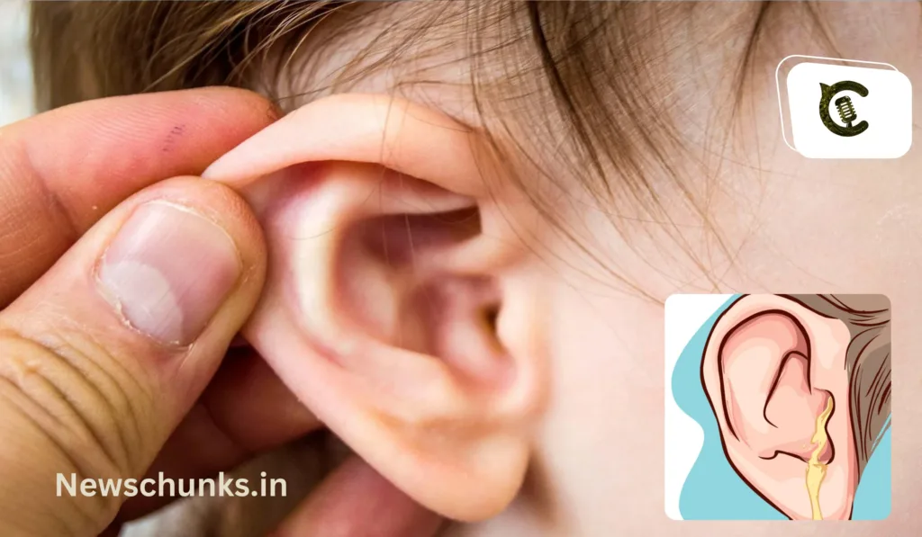 problem of ear discharge: कान बहने की समस्या से हैं परेशान? जानें क्या हैं कान बहने के कारण