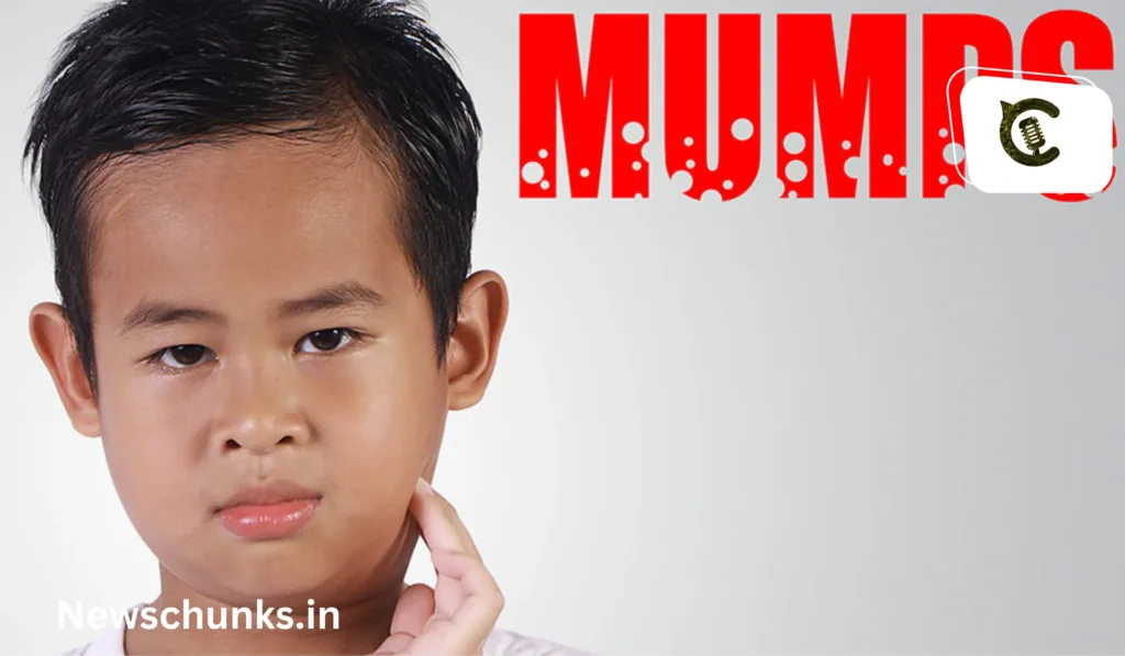Kya Hain Mumps: क्या है Mumps? केरल में तेजी से फैल रही ये बीमारी, जानें लक्षण और बचाव