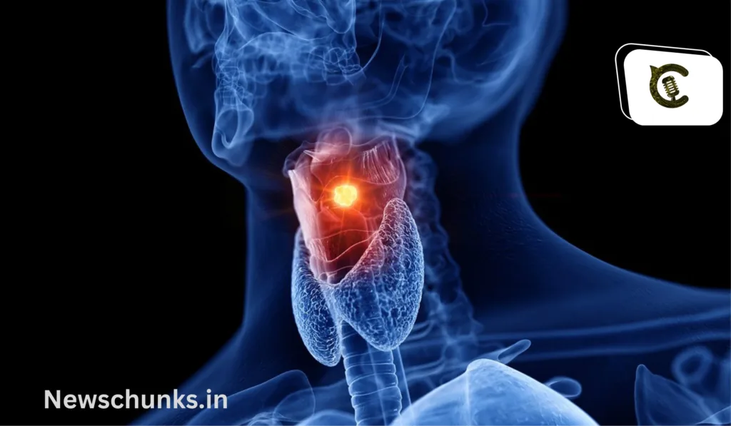 Sushil Kumar Modi has throat cancer: BJP नेता Sushil Kumar Modi 6 महीने से किस कैंसर से जूझ रहे हैं, जानें क्या हैं इसके लक्षण